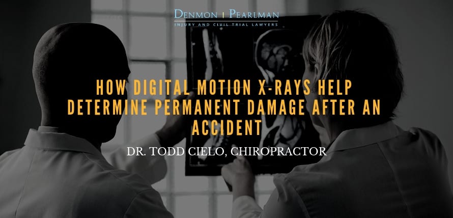 Digital Motion X-Rays