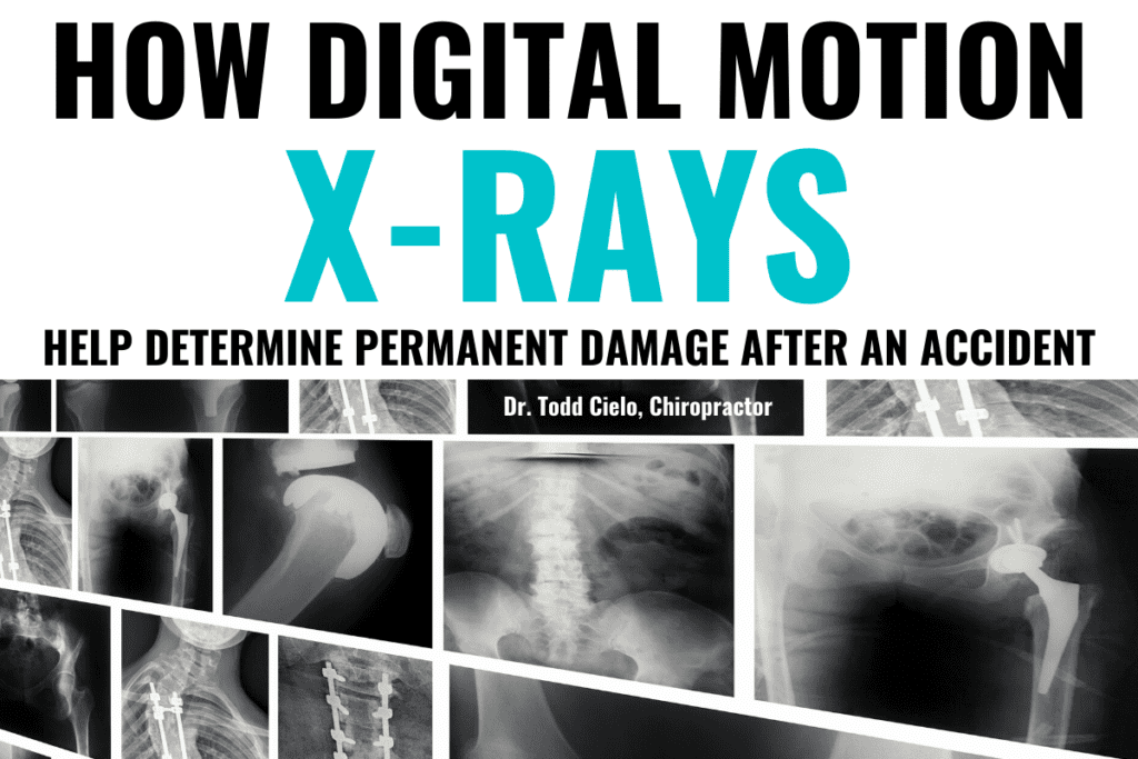 How Digital Motion X Rays help determine permanent damage after an accident Blog