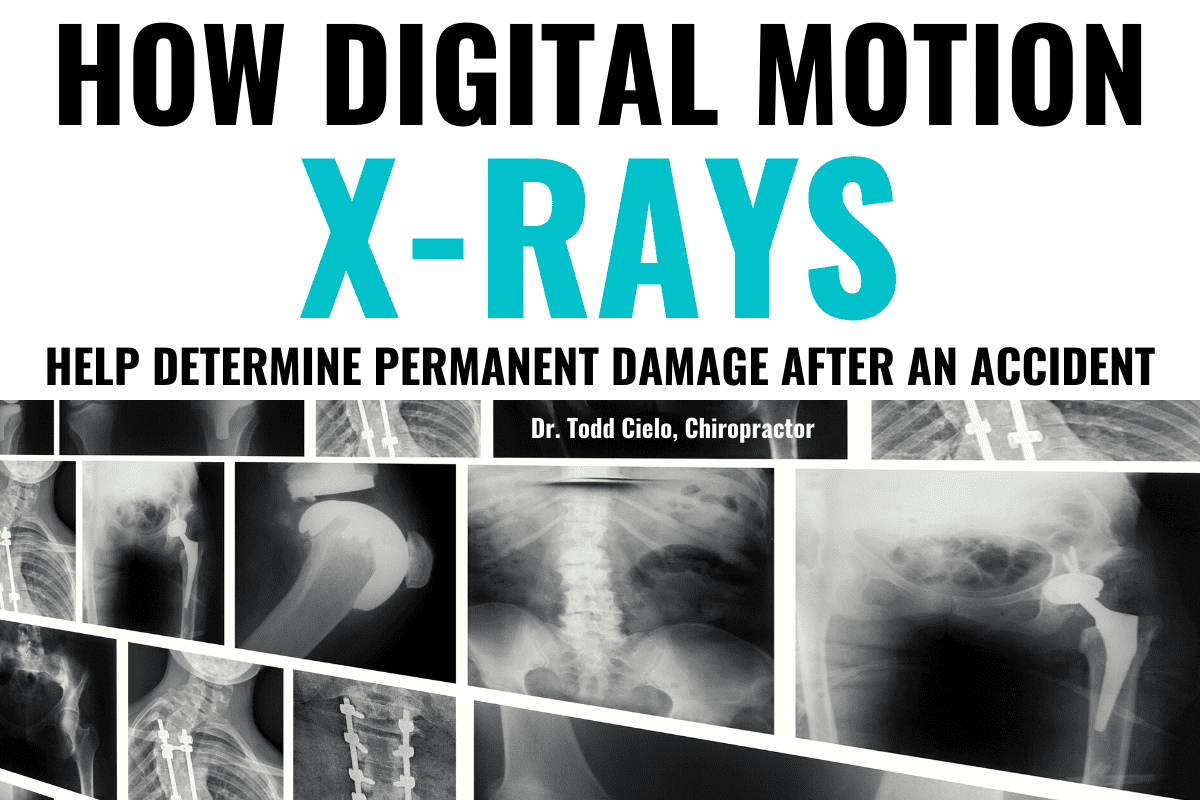 How Digital Motion XRays Help Determine Permanent Damage After an