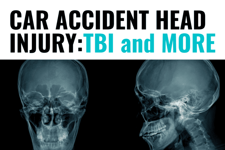 Types, Signs, & Symptoms of a Car Accident Head Injury