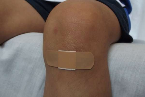 knee injury